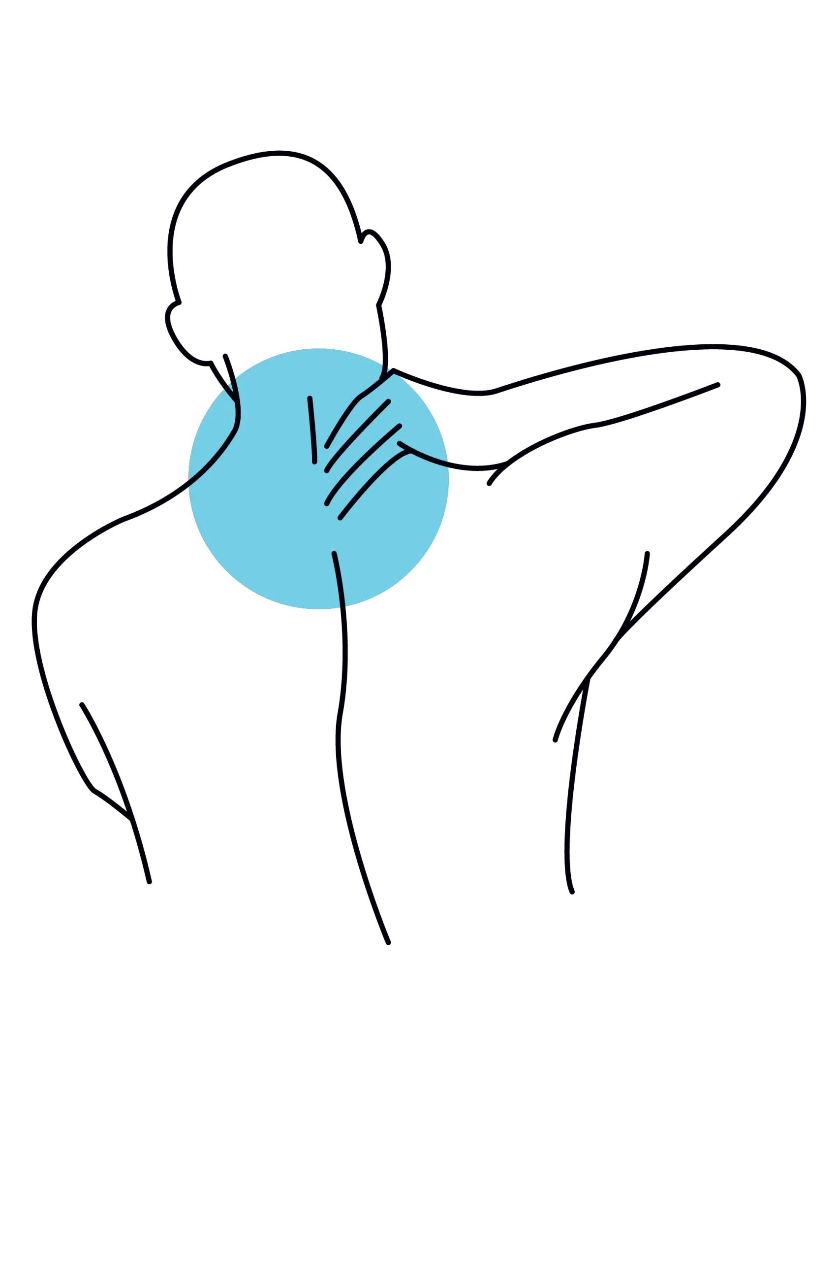 Diagram showing upper back pain area highlighted