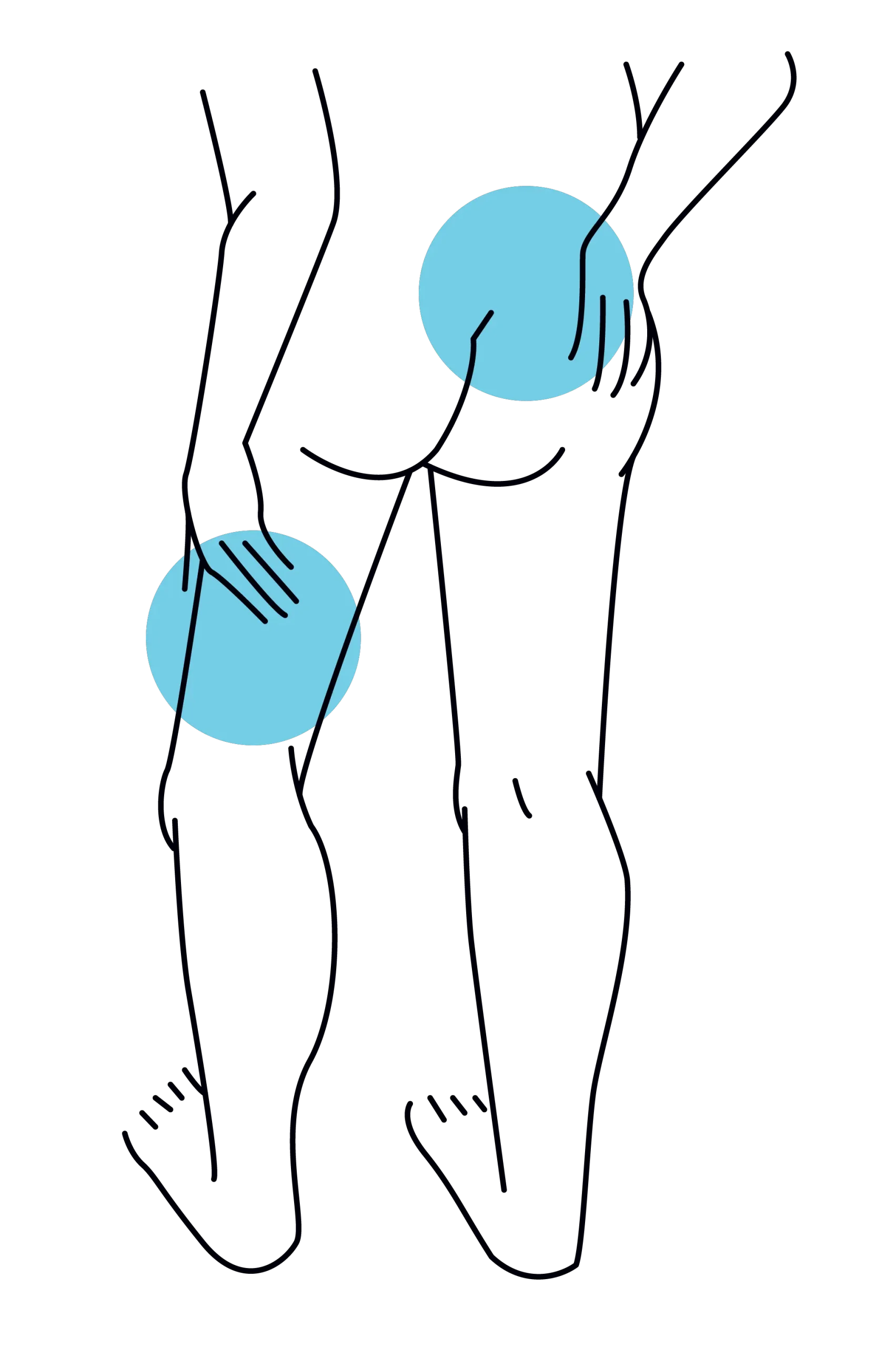 Illustration showing sciatica pain clinic treatment in Edinburgh